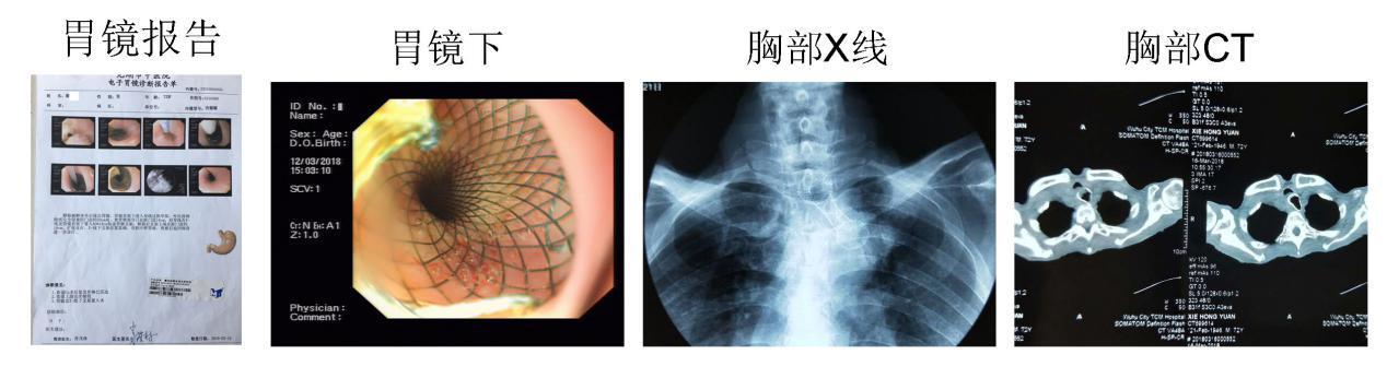 內(nèi)鏡創(chuàng)新工作永遠(yuǎn)在路上(圖5)