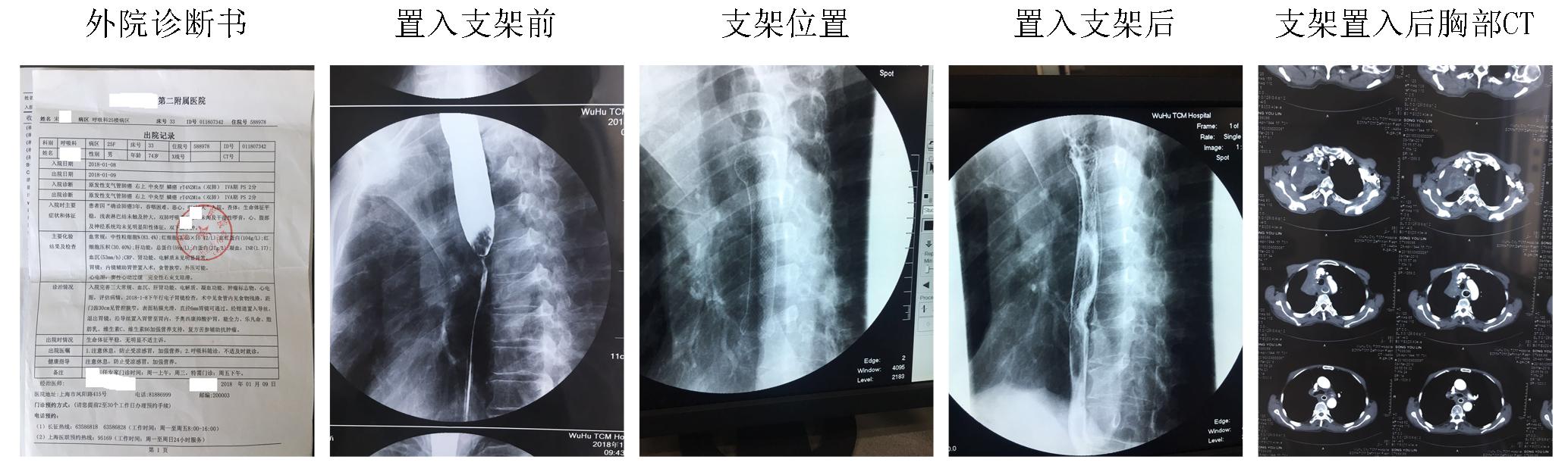 內(nèi)鏡創(chuàng)新工作永遠(yuǎn)在路上(圖2)