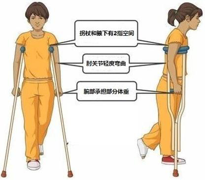 拐杖的“左右為難”——您會正確使用拐杖嗎？(圖4)